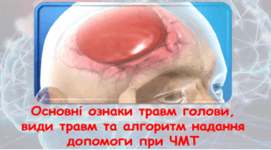Травми голови
