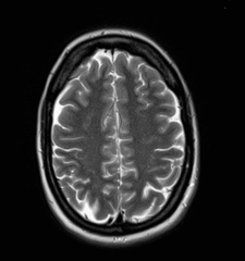 08008xi0-d41d-225x240.png