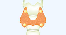 0800p021-abce-201x106.jpg