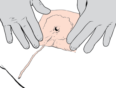 0800y222-6544-385x293.png