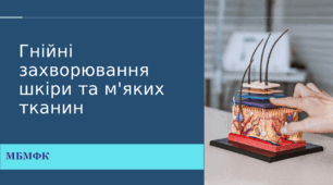 Місцеві гнійні захворювання шкіри, ПШЖК.