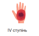 0801g21z-f176-137x127.png